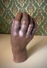 Støpeform/ figur/ skulptur hånd/ neve i kobber - Lærdal/ Laerdal Medical Stavanger Norge  thumbnail